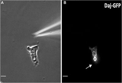 The Polarized Redistribution of the Contractile Vacuole to the Rear of the Cell is Critical for Streaming and is Regulated by PI(4,5)P2-Mediated Exocytosis